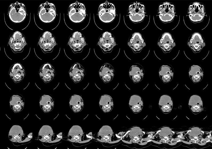 semantic-segmentation